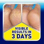 Scholl Cracked Heel Repair Cream ,Visible Results in 3 Days (2 x 60ml). - shopperskartuae