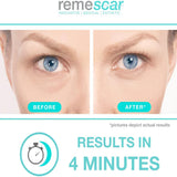 Remescar Eye Bags & Dark Circles Remover (8ml). - shopperskartuae